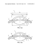 SYSTEM AND DEVICE FOR CORRECTING HYPEROPIA, MYOPIA AND PRESBYOPIA diagram and image