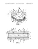 Anatomic total disc replacement diagram and image