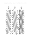 Anatomic total disc replacement diagram and image