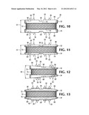 Anatomic total disc replacement diagram and image