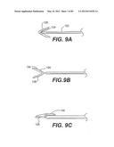 METHOD AND APPARATUS FOR THE TREATMENT OF THE INTERVERTEBRAL DISC ANNULUS diagram and image