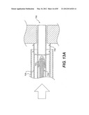 METHOD AND APPARATUS FOR THE TREATMENT OF THE INTERVERTEBRAL DISC ANNULUS diagram and image