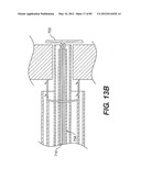 METHOD AND APPARATUS FOR THE TREATMENT OF THE INTERVERTEBRAL DISC ANNULUS diagram and image