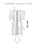 METHOD AND APPARATUS FOR THE TREATMENT OF THE INTERVERTEBRAL DISC ANNULUS diagram and image