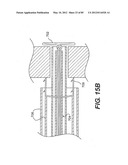 METHOD AND APPARATUS FOR THE TREATMENT OF THE INTERVERTEBRAL DISC ANNULUS diagram and image