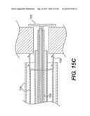 METHOD AND APPARATUS FOR THE TREATMENT OF THE INTERVERTEBRAL DISC ANNULUS diagram and image