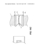 METHOD AND APPARATUS FOR THE TREATMENT OF THE INTERVERTEBRAL DISC ANNULUS diagram and image