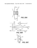 METHOD AND APPARATUS FOR THE TREATMENT OF THE INTERVERTEBRAL DISC ANNULUS diagram and image