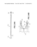 METHOD AND APPARATUS FOR THE TREATMENT OF THE INTERVERTEBRAL DISC ANNULUS diagram and image