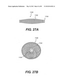 METHOD AND APPARATUS FOR THE TREATMENT OF THE INTERVERTEBRAL DISC ANNULUS diagram and image