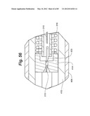 METHOD AND APPARATUS FOR THE TREATMENT OF THE INTERVERTEBRAL DISC ANNULUS diagram and image