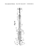 METHOD AND APPARATUS FOR THE TREATMENT OF THE INTERVERTEBRAL DISC ANNULUS diagram and image