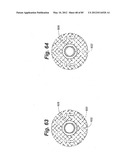 METHOD AND APPARATUS FOR THE TREATMENT OF THE INTERVERTEBRAL DISC ANNULUS diagram and image