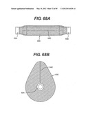 METHOD AND APPARATUS FOR THE TREATMENT OF THE INTERVERTEBRAL DISC ANNULUS diagram and image