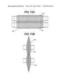 METHOD AND APPARATUS FOR THE TREATMENT OF THE INTERVERTEBRAL DISC ANNULUS diagram and image