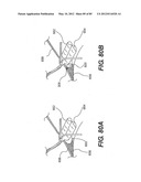 METHOD AND APPARATUS FOR THE TREATMENT OF THE INTERVERTEBRAL DISC ANNULUS diagram and image