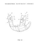 Systems and methods Utilizing Patient-Matched Instruments diagram and image