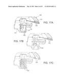 Systems and methods Utilizing Patient-Matched Instruments diagram and image