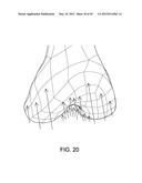 Systems and methods Utilizing Patient-Matched Instruments diagram and image