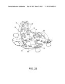 Systems and methods Utilizing Patient-Matched Instruments diagram and image