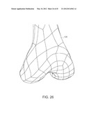 Systems and methods Utilizing Patient-Matched Instruments diagram and image