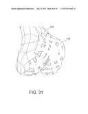 Systems and methods Utilizing Patient-Matched Instruments diagram and image