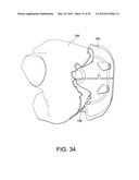 Systems and methods Utilizing Patient-Matched Instruments diagram and image