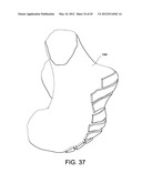 Systems and methods Utilizing Patient-Matched Instruments diagram and image