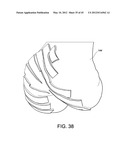 Systems and methods Utilizing Patient-Matched Instruments diagram and image