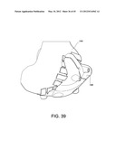 Systems and methods Utilizing Patient-Matched Instruments diagram and image