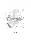 Systems and methods Utilizing Patient-Matched Instruments diagram and image