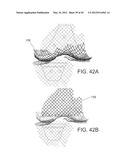 Systems and methods Utilizing Patient-Matched Instruments diagram and image