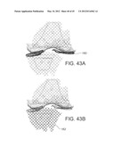 Systems and methods Utilizing Patient-Matched Instruments diagram and image