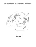 Systems and methods Utilizing Patient-Matched Instruments diagram and image