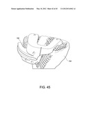 Systems and methods Utilizing Patient-Matched Instruments diagram and image