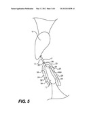 Intra-Oral Device and Method of Relieving Head, Neck, Facial, Joint and     Tooth Pain diagram and image