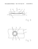 PLASMA SEPARATION RESERVOIR diagram and image