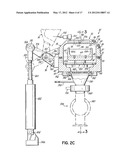 Plasma Treatment System diagram and image