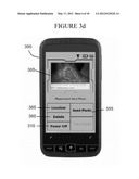 WOUND MANAGEMENT MOBILE IMAGE CAPTURE DEVICE diagram and image