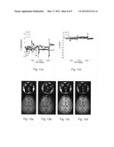 Method for optical pose detection diagram and image