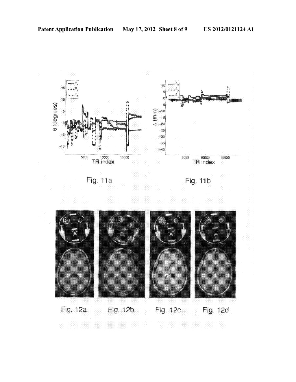 Method for optical pose detection - diagram, schematic, and image 09