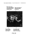 MEDICAL IMAGE PROCESSING APPARATUS diagram and image