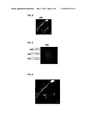 Method and System for Automatic View Planning for Cardiac Magnetic     Resonance Imaging acquisition diagram and image