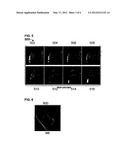 Method and System for Automatic View Planning for Cardiac Magnetic     Resonance Imaging acquisition diagram and image