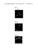 Method and System for Automatic View Planning for Cardiac Magnetic     Resonance Imaging acquisition diagram and image