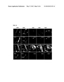 Method and System for Automatic View Planning for Cardiac Magnetic     Resonance Imaging acquisition diagram and image