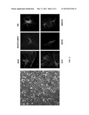 PRODUCTION OF OLIGODENDROCYTES FROM PLACENTA-DERIVED STEM CELLS diagram and image