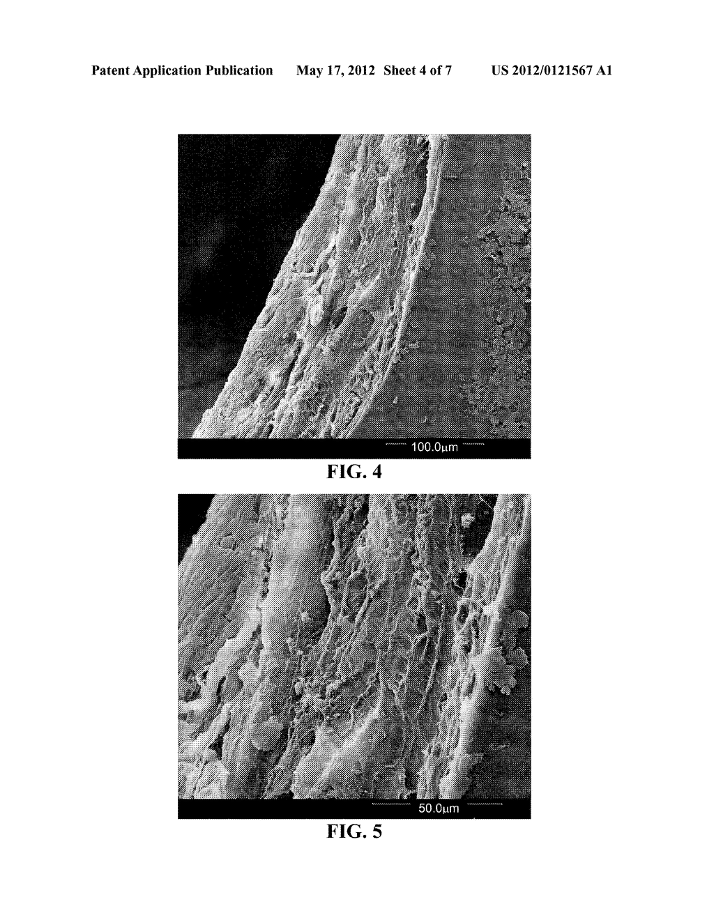 OPHTHALMIC SOLUTION FOR PROTECTING INTERNAL STRUCTURES OF THE EYEBALL     AGAINST UV-A RAYS OR FOR THE TREATMENT OF KERATOCONUS WITH A     TRANS-EPITHELIAL CROSS-LINKING TECHNIQUE - diagram, schematic, and image 05