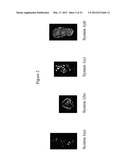 BONE VOID FILLERS diagram and image