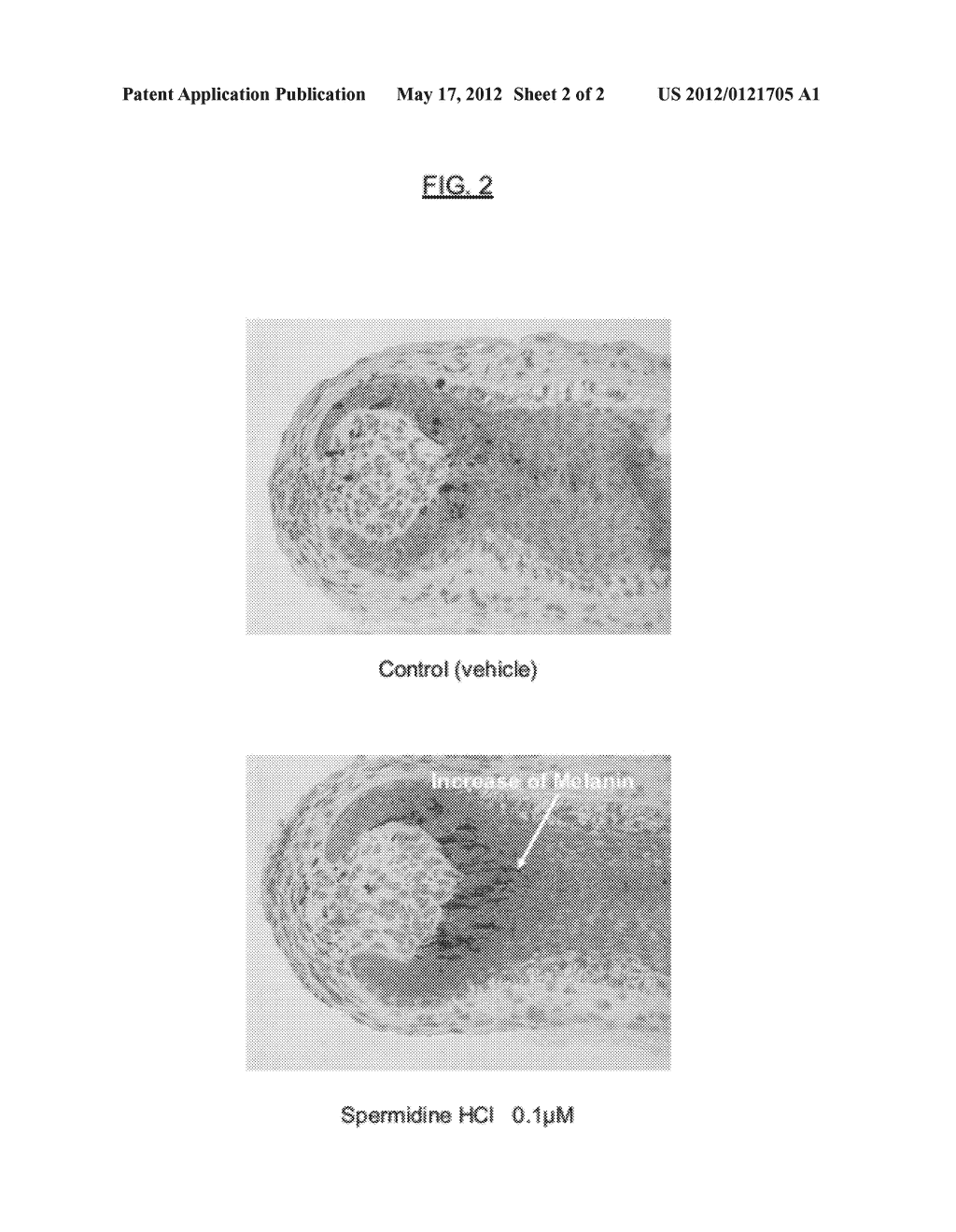 Pharmaceutical Or Cosmetic Or Dietetic Composition Suitable For Promoting     A Hair Pigmentation Effect - diagram, schematic, and image 03